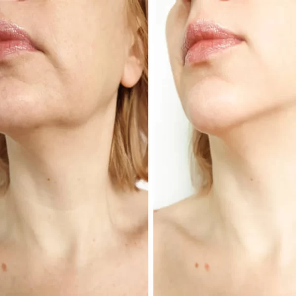 Dra. Natalia Argüello - Medicina y cirugía estética